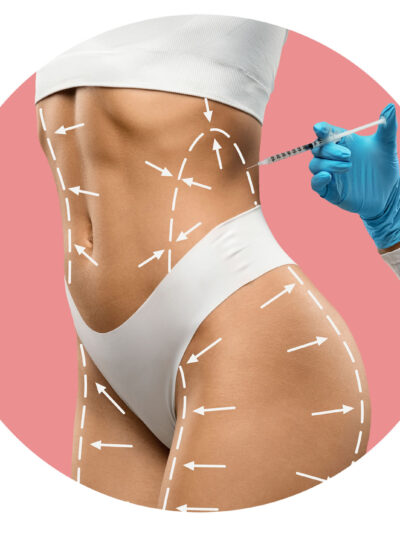 Fat Dissolving Injections