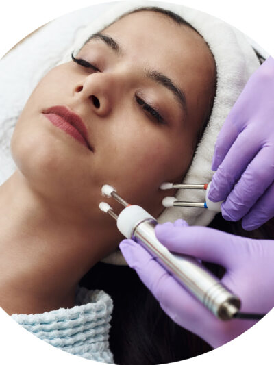 Radiofrequency Microneedling